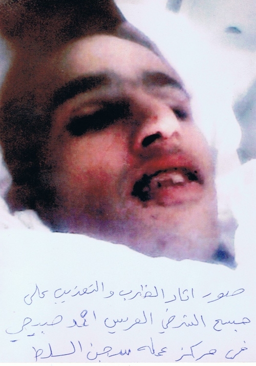 صورة المتوفي واثار ضرب على فمه