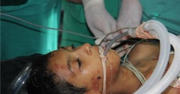 سبعة شهداء بينهم خمسة اطفال في سلسلة غارات على القطاع