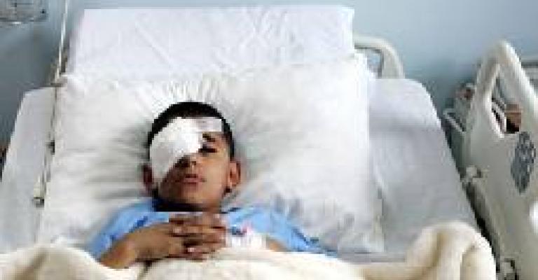 استئصال عين الطالب الدويكات استئصال عين الطالب الدويكات