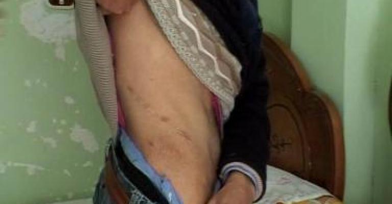 الأردن يتسلم مواطنا متهما بالاتجار بالاعضاء البشرية