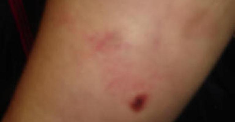 ‘Najwa’ victim of torture on Woman’s Day