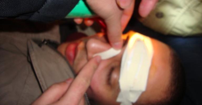 المستشفيات المحيطة بالداخلية تستقبل عشرات الإصابات بعضها خطيرة 