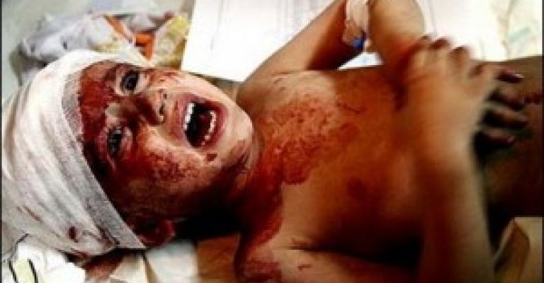 أنا لست بأنسان أنا لست بأنسان