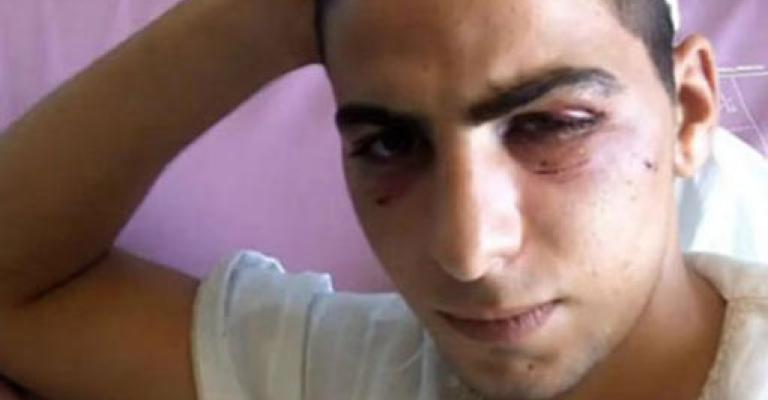 الحريات النيابية تدين اعتداء الأمن على القلالوة الحريات النيابية تدين اعتداء الأمن على القلالوة