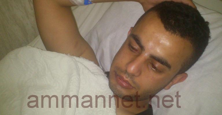صور- الامن يعتدي على شاب في اربد صور- الامن يعتدي على شاب في اربد