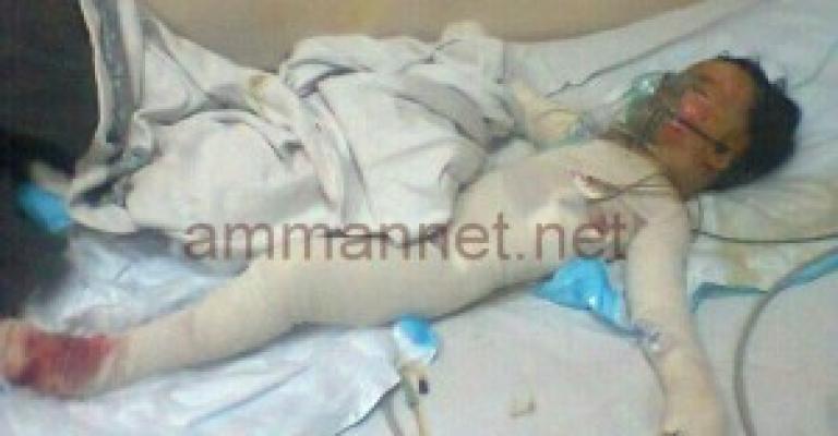 من المسؤول عن احتراق الأطفال في الزعتري ؟ - صوت