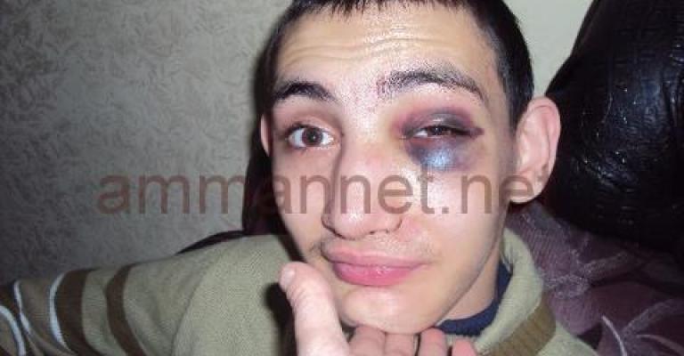 عام على زيارة الملك لمراكز المعاقين .. الانتهاكات مستمرة!