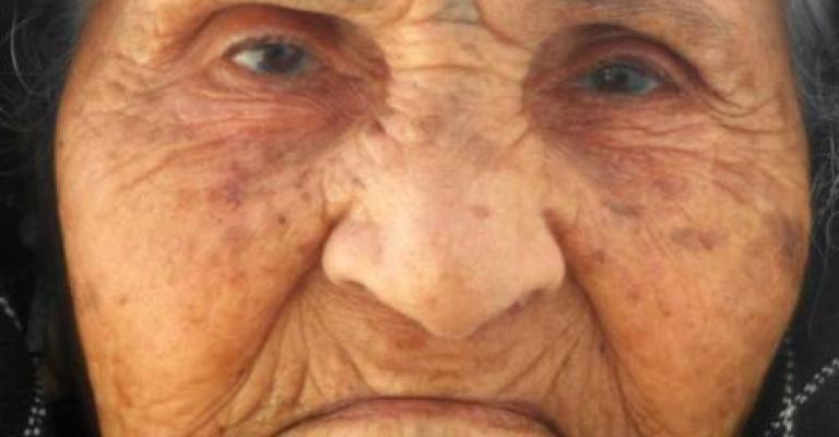 مسنات في الزرقاء يمضين خريف العمر بانتظار من لا يأتون مسنات في الزرقاء يمضين خريف العمر بانتظار من لا يأتون