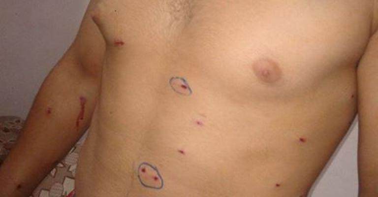 مناشدات من مخيم غزّة لوقف اعتقال المصابين والغاز المسيل للدموع