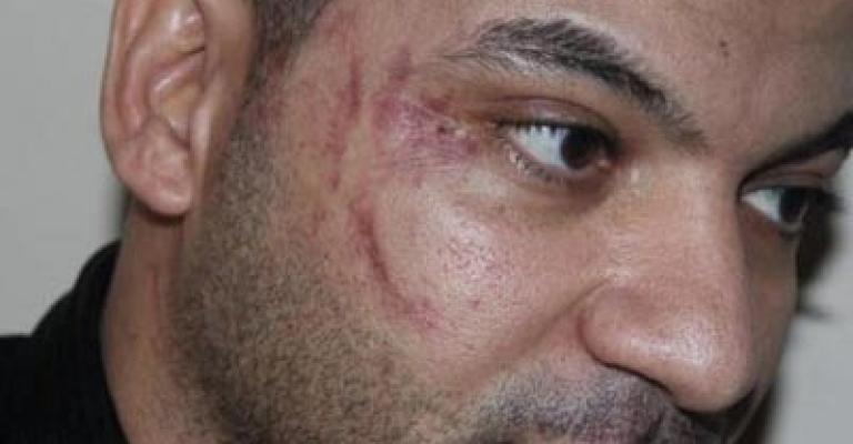 قضية العامل المصري... السفارة تتجه للقضاء من جديد قضية العامل المصري... السفارة تتجه للقضاء من جديد