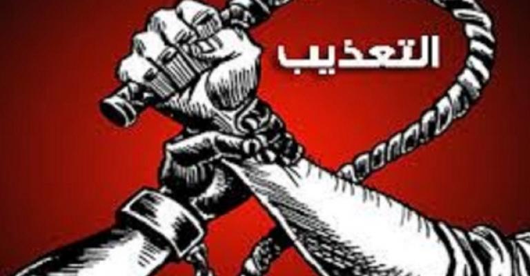 مركز عدالة يناقش دور الاعلام في مناهضة التعذيب