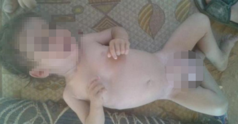 الجيش ينفي منع طفل في "الركبان" من الدخول للعلاج.. والصليب الأحمر: لا نستطيع الدخول