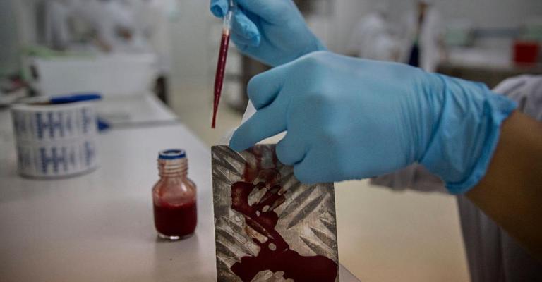 "ليزر الدماء" للعثور على الأورام في الجسم