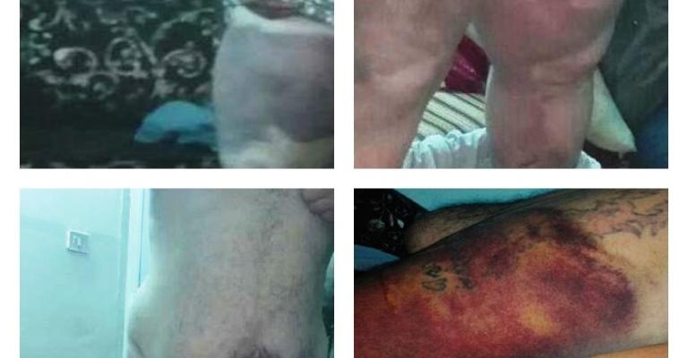 مواطن يدعي الاعتداء عليه في مركز أمني