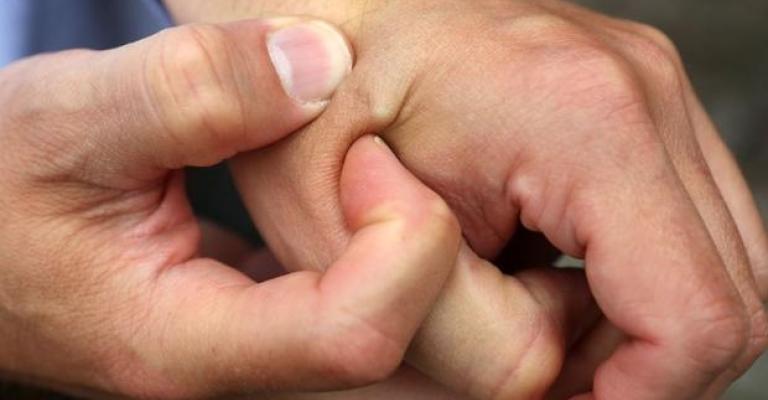 شركة توفر خيار زرع شريحة داخل أيدي موظفيها