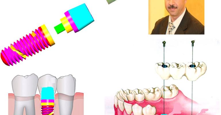 أكاديمي من "الأردنية" يسجل براءة اختراع في الغرسات السنية