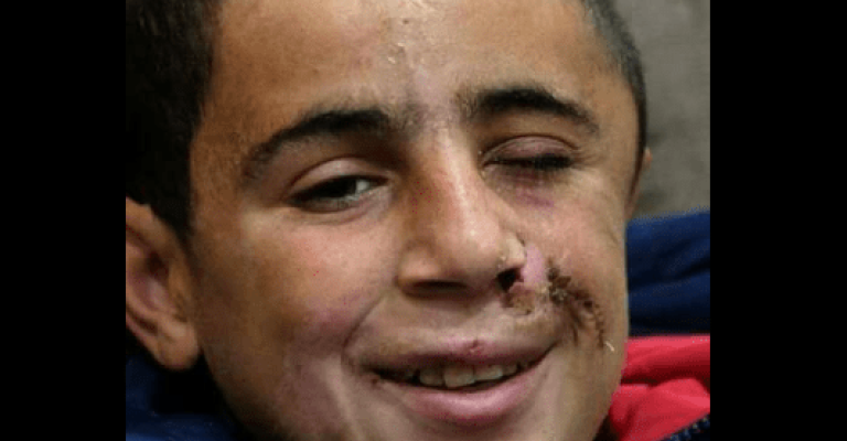 الطفل التميمي : الرصاصة برأسي والمقاومة بقلبي الطفل التميمي : الرصاصة برأسي والمقاومة بقلبي