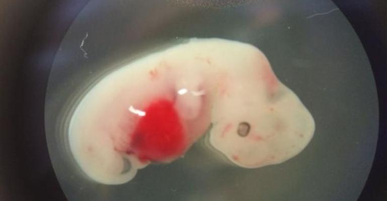 أول هجين من البشر والأغنام.. هذا تأثيره على علاج السكري أول هجين من البشر والأغنام.. هذا تأثيره على علاج السكري