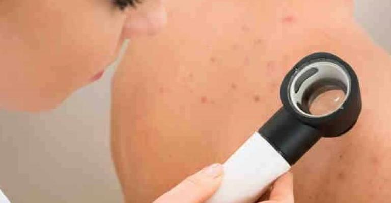 اكاديمية اردنية تكتشف مرضا جلديا نادرا