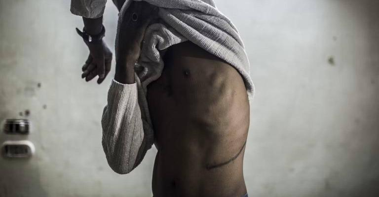 Archive: A Sudanese man testified that he sold his kidney to organ traffickers in 2017.