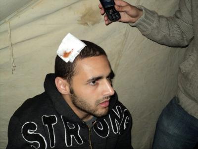 المستشفيات المحيطة بالداخلية تستقبل عشرات الإصابات بعضها خطيرة 