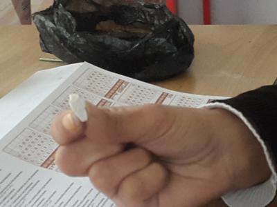 امرأة بالزرقاء تدمن أكل الحجارة منذ عشرين عاما