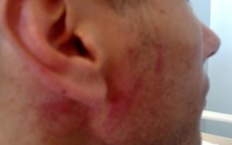 نقابة الممرضين تنظر برفع دعوى ضد المعتدين على الممرضين