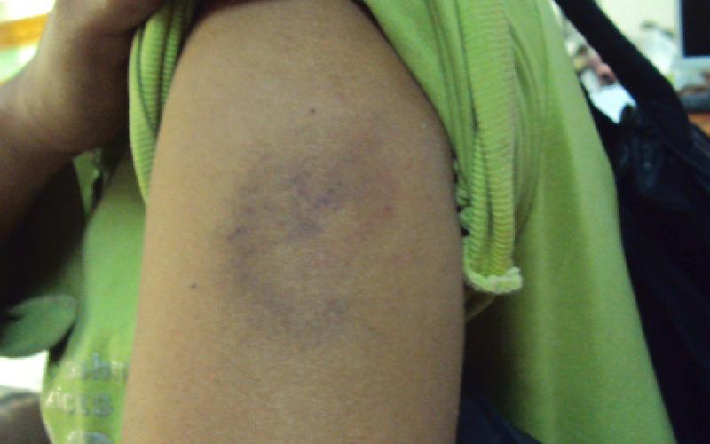 عاملة منزل تلجأ لراديو البلد هربا من معاملة مخدوميها