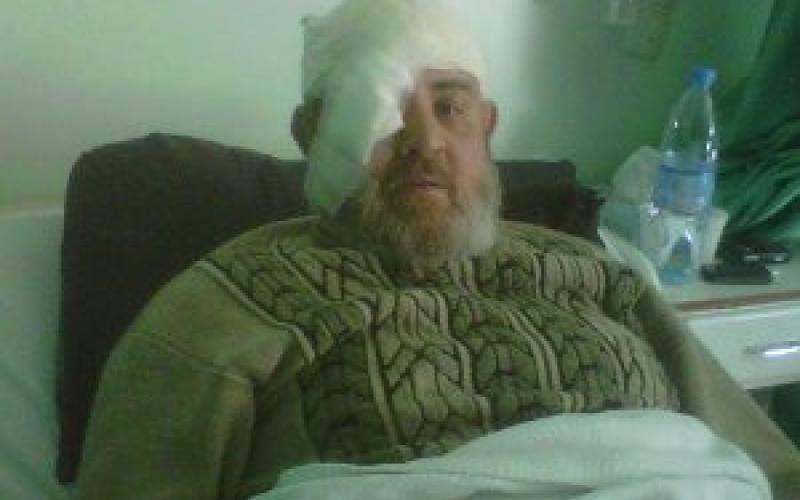 فيديو.. صالح يفقد بصره والخوالدة يعاني كسرا في الجمجمة