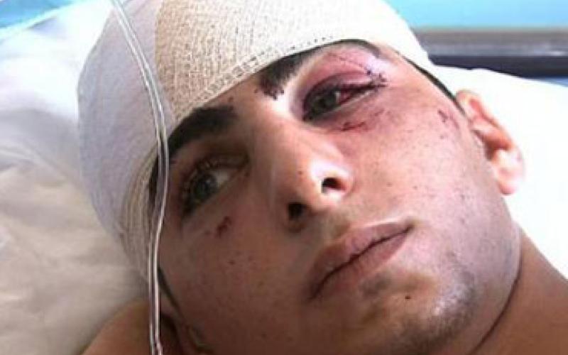 قضية القلالوة تثير خلافا حادا بين الامن والإعلام