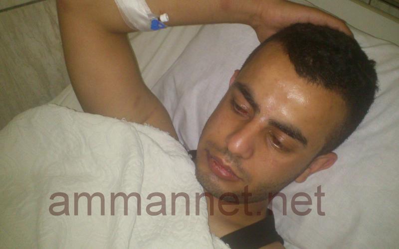 صور- الامن يعتدي على شاب في اربد