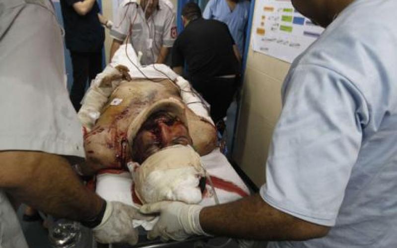  شهيدان بغارتين للاحتلال على غزة 