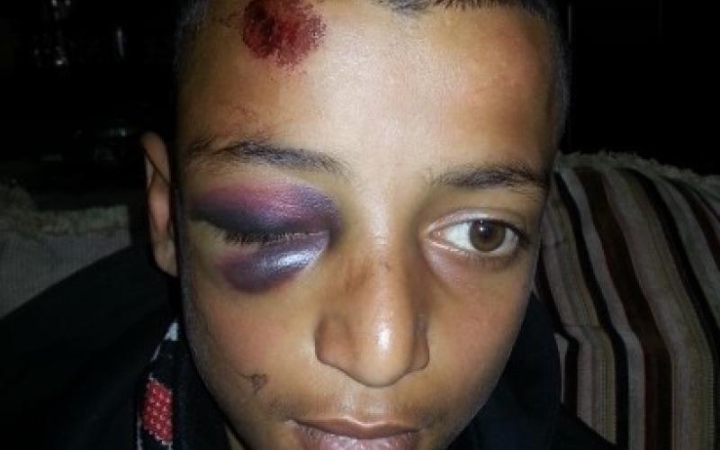 نهاية العام: ذكريات مؤلمة حفرت بذاكرة فتية القدس