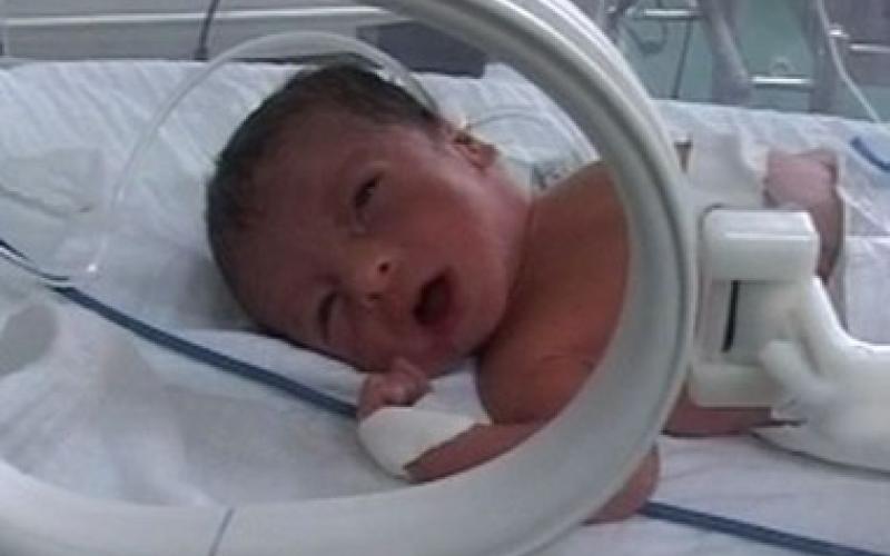 معاناة "الخدج" السوريين ..بين ضيق حال الأهالي ومماطلة المسؤولين