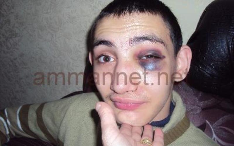 طفل معاق ضحية للانتهاكات في مراكز الرعاية- عدسة حنان خندقجي 