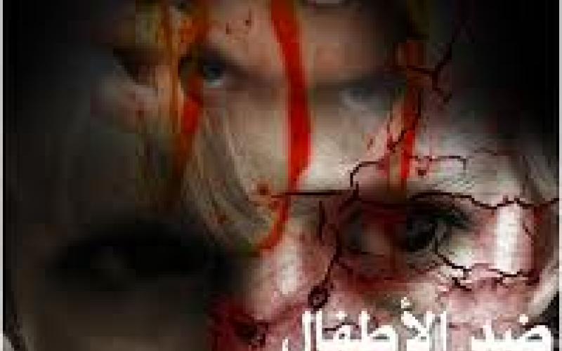 عائلة تحرق ابنها بسياخ الشواء