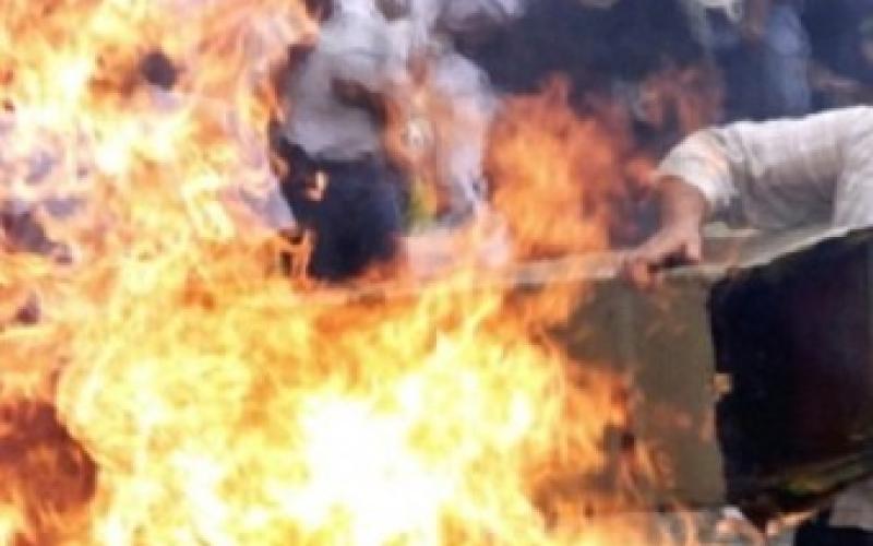 غزة: وفاة مواطن أضرم النار بنفسه