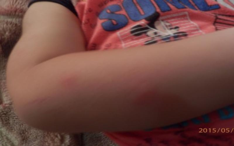 الحشرات تقض المضاجع بالهاشمية والبلدية تنفي التقصير بمكافحتها