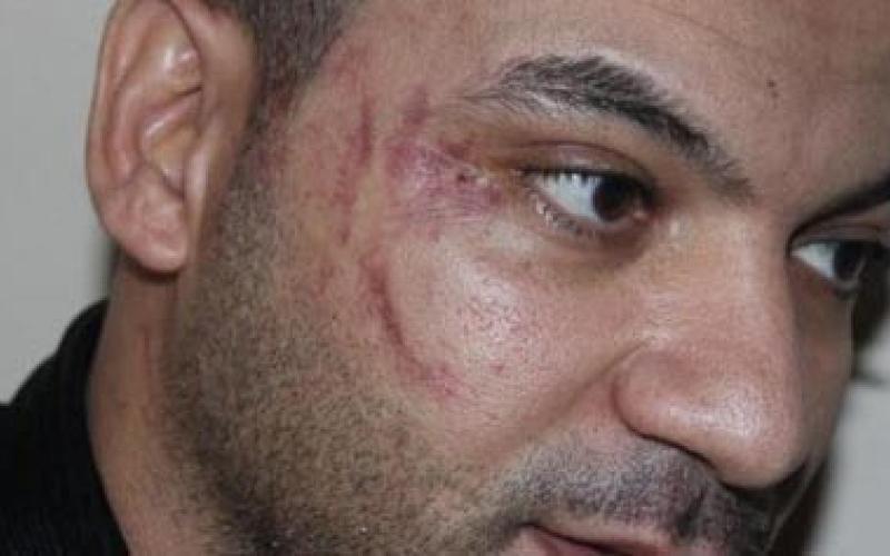 قضية العامل المصري... السفارة تتجه للقضاء من جديد