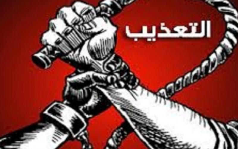 مركز عدالة يناقش دور الاعلام في مناهضة التعذيب