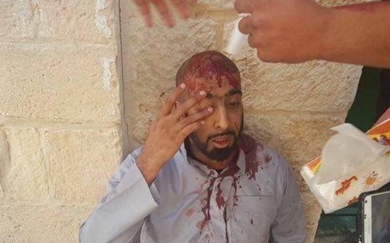 إصابات واعتقالات باقتحام مستوطنين وشرطة الاحتلال للأقصى