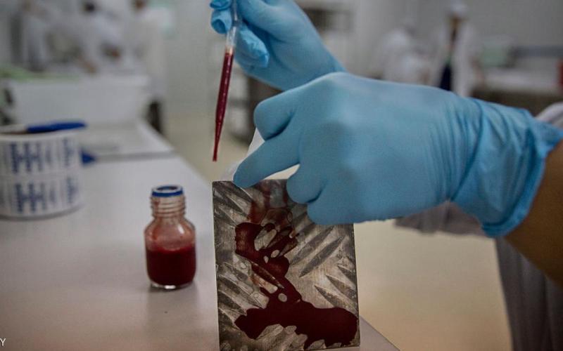 "ليزر الدماء" للعثور على الأورام في الجسم