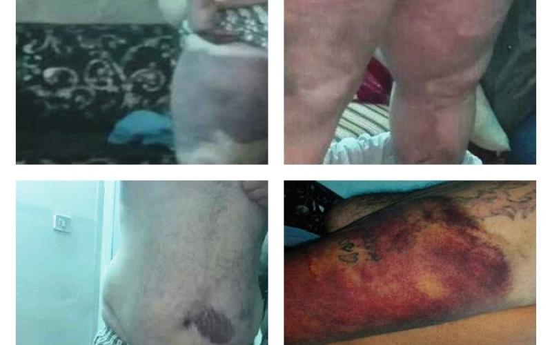 مواطن يدعي الاعتداء عليه في مركز أمني