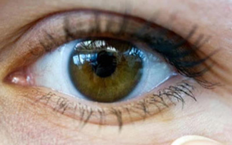 اطلاق حملة مكافحة فقدان البصر في السلط