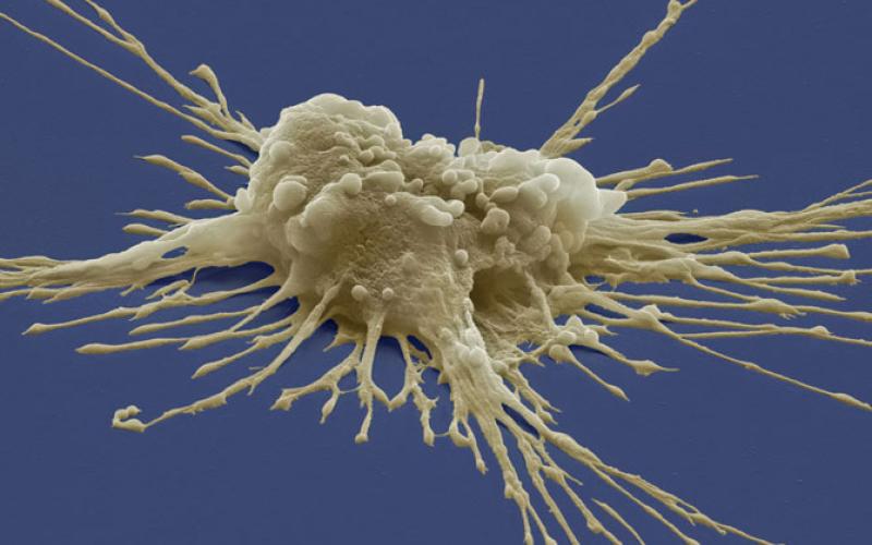 "الصحة" : لم نصدر اي ترخيص علاجي لمراكز خلايا جذعية