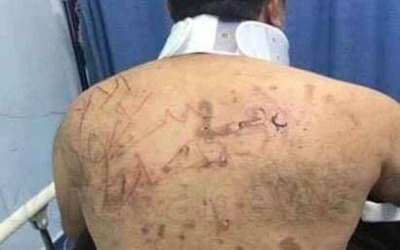 المدعي العام يسند (4) تهم ليونس قنديل