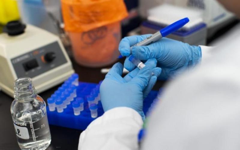 17 إصابة بالفيروس